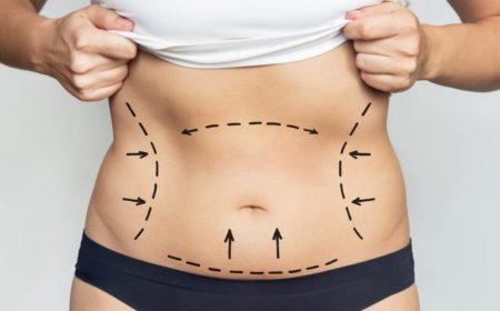 What to Expect at Every Step of Liposuction Surgery in Dubai