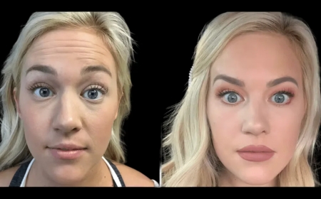 The Ultimate Botox Guide by the Best Plastic Surgeon in dubai