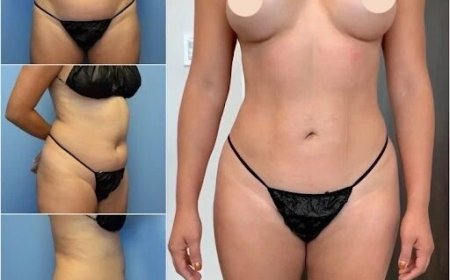 Get Beautifully Sculpted Results with the Best Body Contouring Surgeon in Dubai