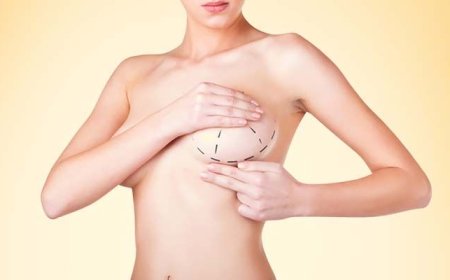 What Are the Benefits of Choosing the Best Breast Augmentation Surgeon in Dubai for Your Procedure