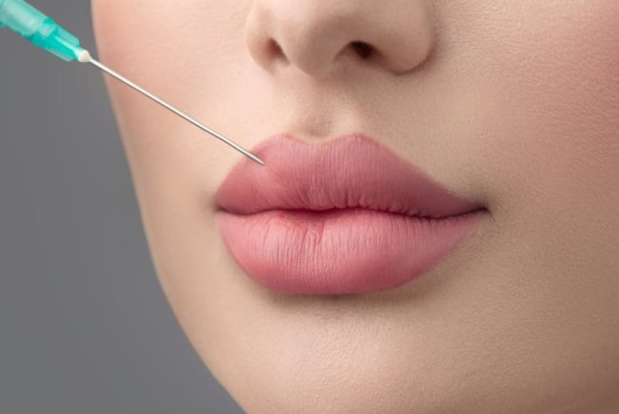 Russian Lip Fillers and Lip Contouring at the Best Plastic Surgeon in Dubai