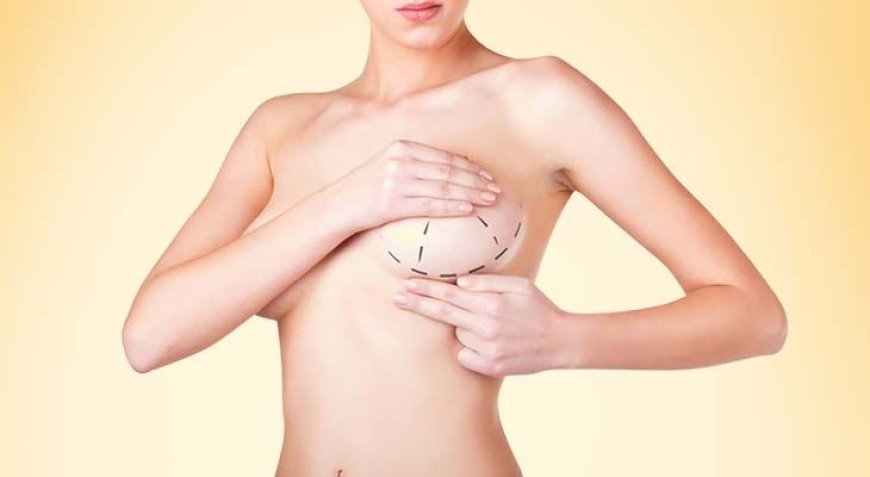 What Are the Benefits of Choosing the Best Breast Augmentation Surgeon in Dubai for Your Procedure