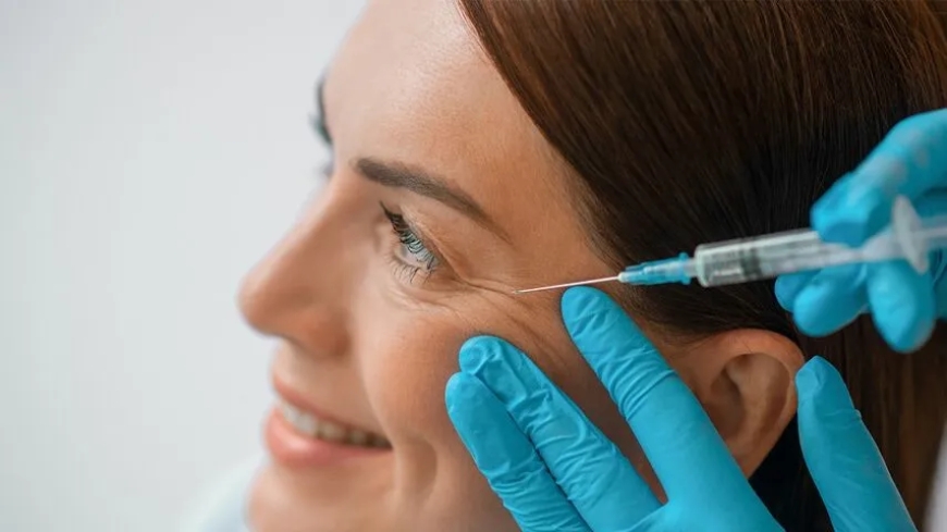 Botox in Dubai: Can Botox Prevent Wrinkles Before They Appear