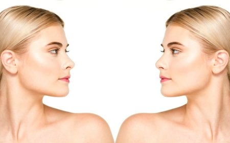 What to Expect from Ultrasonic Rhinoplasty Dubai: A Modern Nose Reshaping Approach