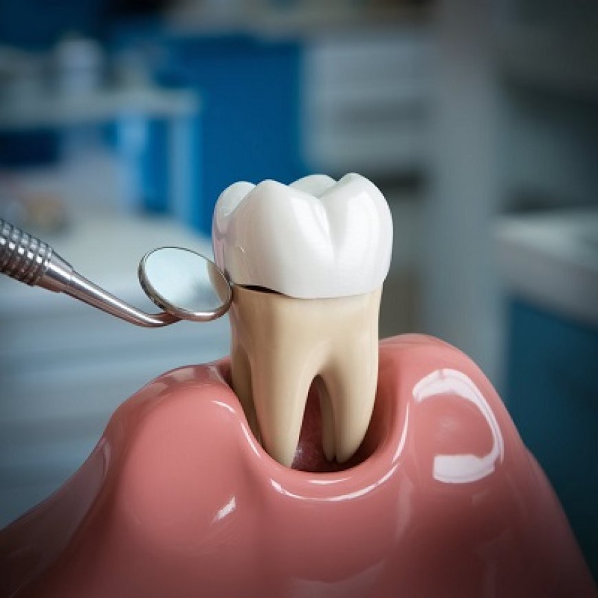 A Dental Crown Can Save a Tooth