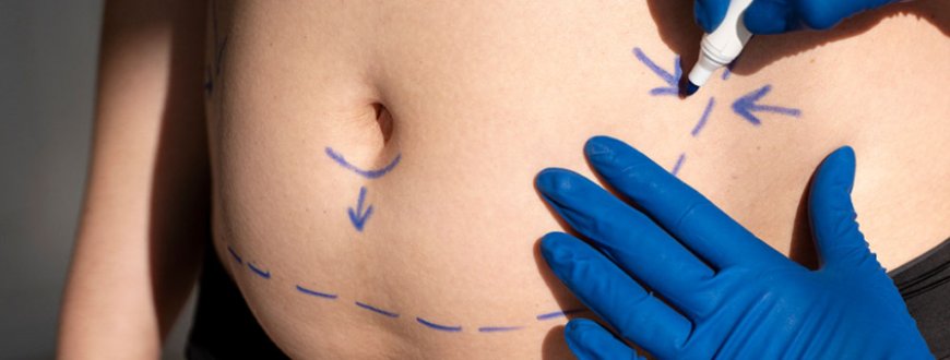 How Abdominoplasty in Dubai Can Transform Your Body and Boost Confidence