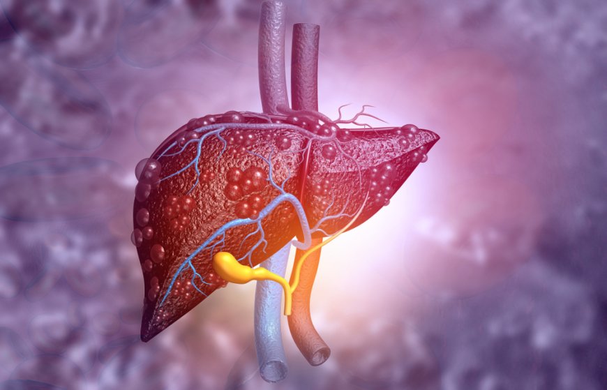 How to Prepare for a Liver Function Test with GGT