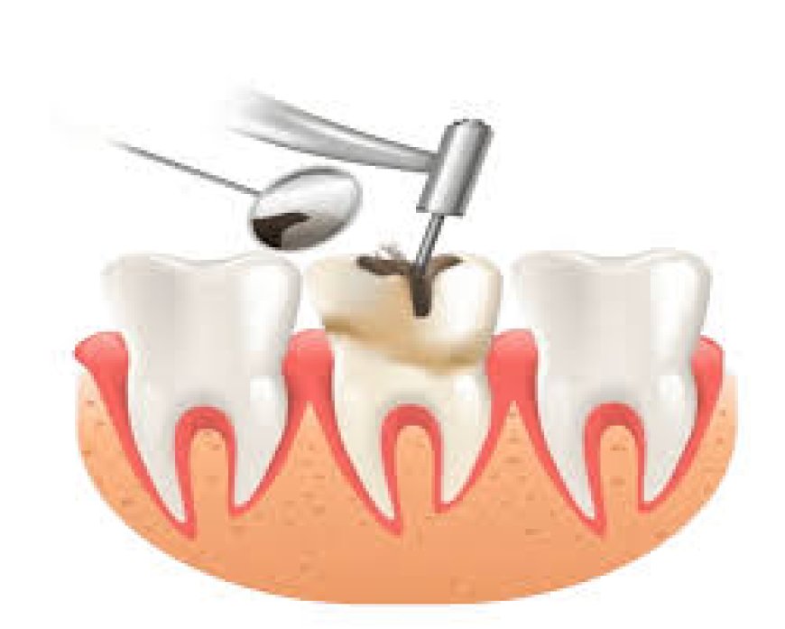 Root Canal Treatment Cost: Your Complete Guide to Affordable Dental Care