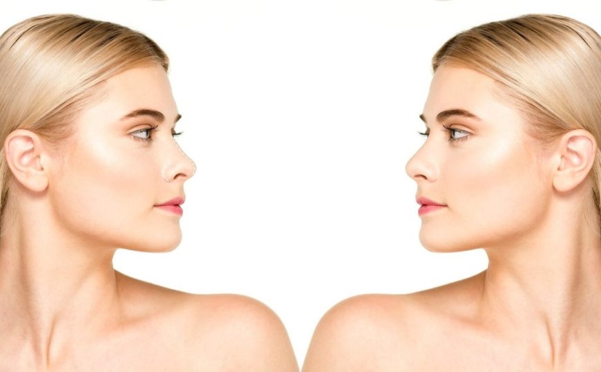 What to Expect from Ultrasonic Rhinoplasty Dubai: A Modern Nose Reshaping Approach